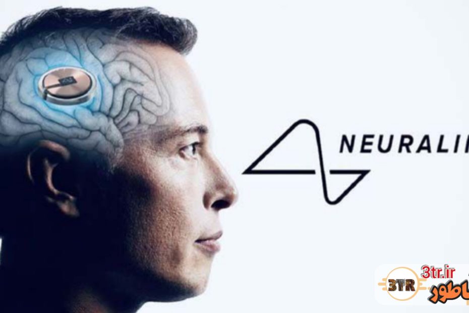 دستاورد بزرگ ایلان ماسک؛ بیمار کم‌توان نورالینک ازطریق افکارش شطرنج بازی می‌کند!